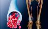 Dieta a výživa hluboká žilní trombóza dolních končetin