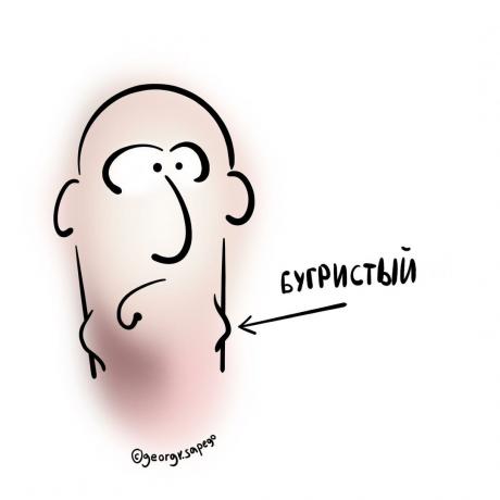 hrudkovitý lymfatických uzlin