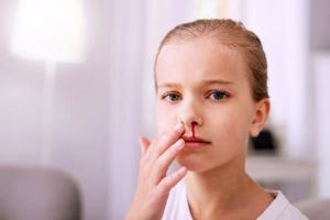 Jak zastavit krvácení dítěte z nosu: rada pediatra