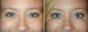 Jaká kombinace kosmetických procedur bude bombichesky vliv na váš obličej