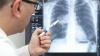 Lékař porovnává radiační expozici s CT plic se zářením v Hirošimě