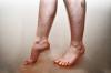 Narušení průtoku krve v nohou: příčiny, příznaky