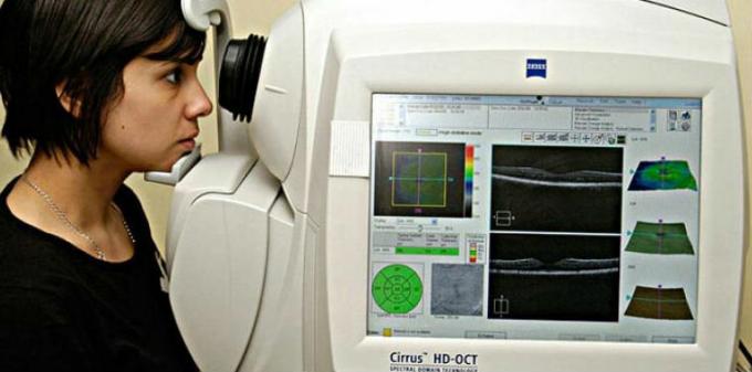 Optická koherentní tomografie angiografie