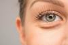Váčky pod očima: kosmetička poradit, jak se zbavit