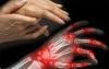 Příznaky a příčiny revmatoidní artritidou jako varovat