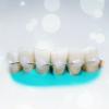 Populární Dlahování zuby: kolik to efektivně?