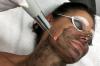 Laser oxidu peeling: všechna kožní problém přináší k ideálu