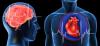Srdeční infarkt a cévní mozková příhoda: 7 velkých chyb, které vyvolávají