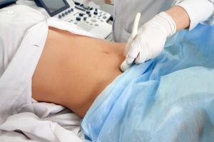 Jak často musíte během těhotenství dělat ultrazvuk, říká lékař