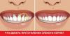 Jak k léčbě dásní, když zuby stát holý krk?