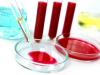 Hladina hemoglobinu v krvi: jak zlepšit?