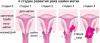 7 příznaky rakoviny děložního čípku, které ženy často ignorují