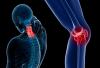 5 náznaky, že máte začíná osteoporózy